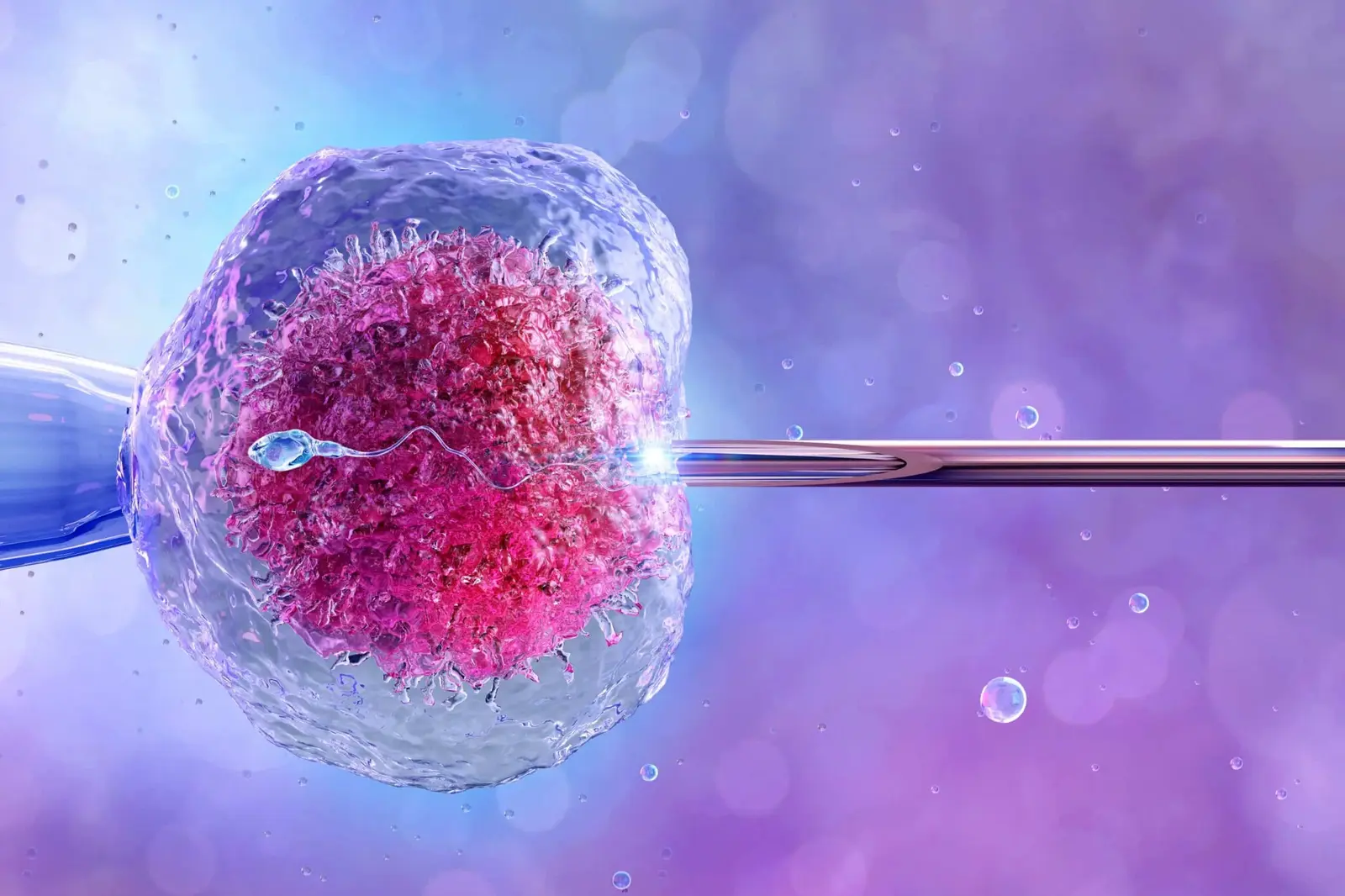 Intracytoplasmic sperm injection during IVF embryo creation